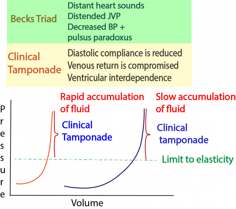 Pericardial Tamponade Critical Care Sonography