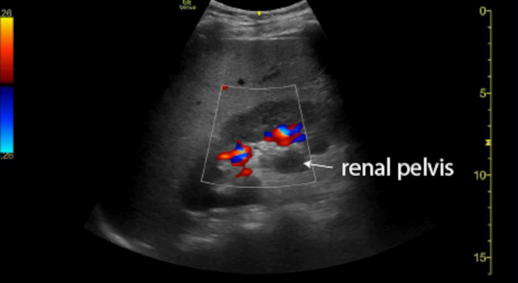 Clinical Cases